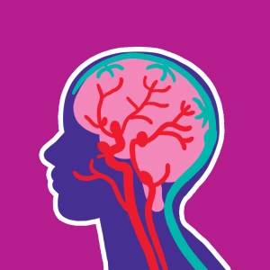 Brain aneurysm