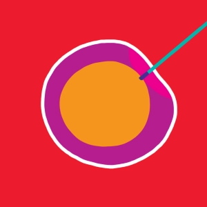 In vitro fertilization (IVF)